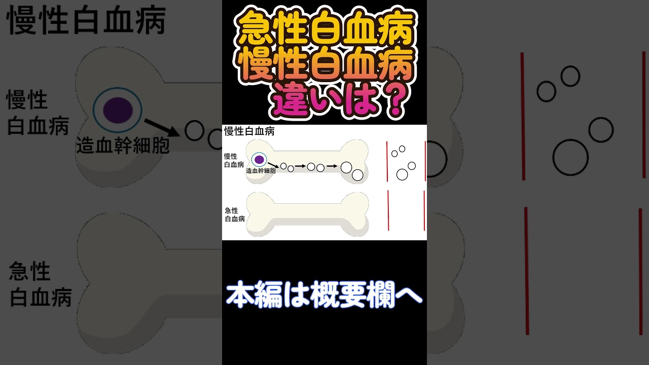 慢性骨髄性白血病の国試頻出ポイント（本編は概要欄から）#Shorts