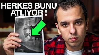 Eksik bir dişin varsa, BU VİDEO SENİ BULACAK !