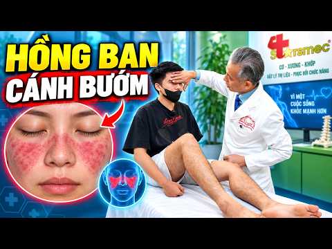 Đến Khám Đau Gối, Bác Sĩ Nhìn Thấy Vết Ban Trên Mặt
