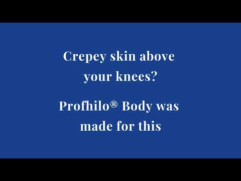 Sculptra vs fillers comparison guide