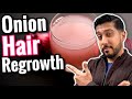 Onion Juice For Hair Growth REGROW Hair With Onion Juice