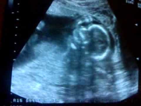 Ultraljud vecka 19