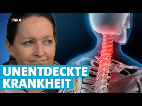 Odyssee bis zur richtigen Diagnose: Instabile Halswirbelsäule - kaum bekannt und Qual für Betroffene