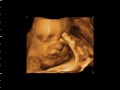 Isabella Briefly Moves Her Foot And Hand Away From Her Face
