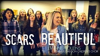Alessia Cara - Scars to Your Beautiful - Cover by Evynne Hollens