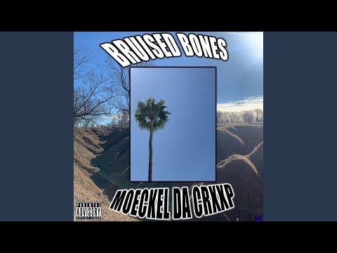 BRUISED BONES