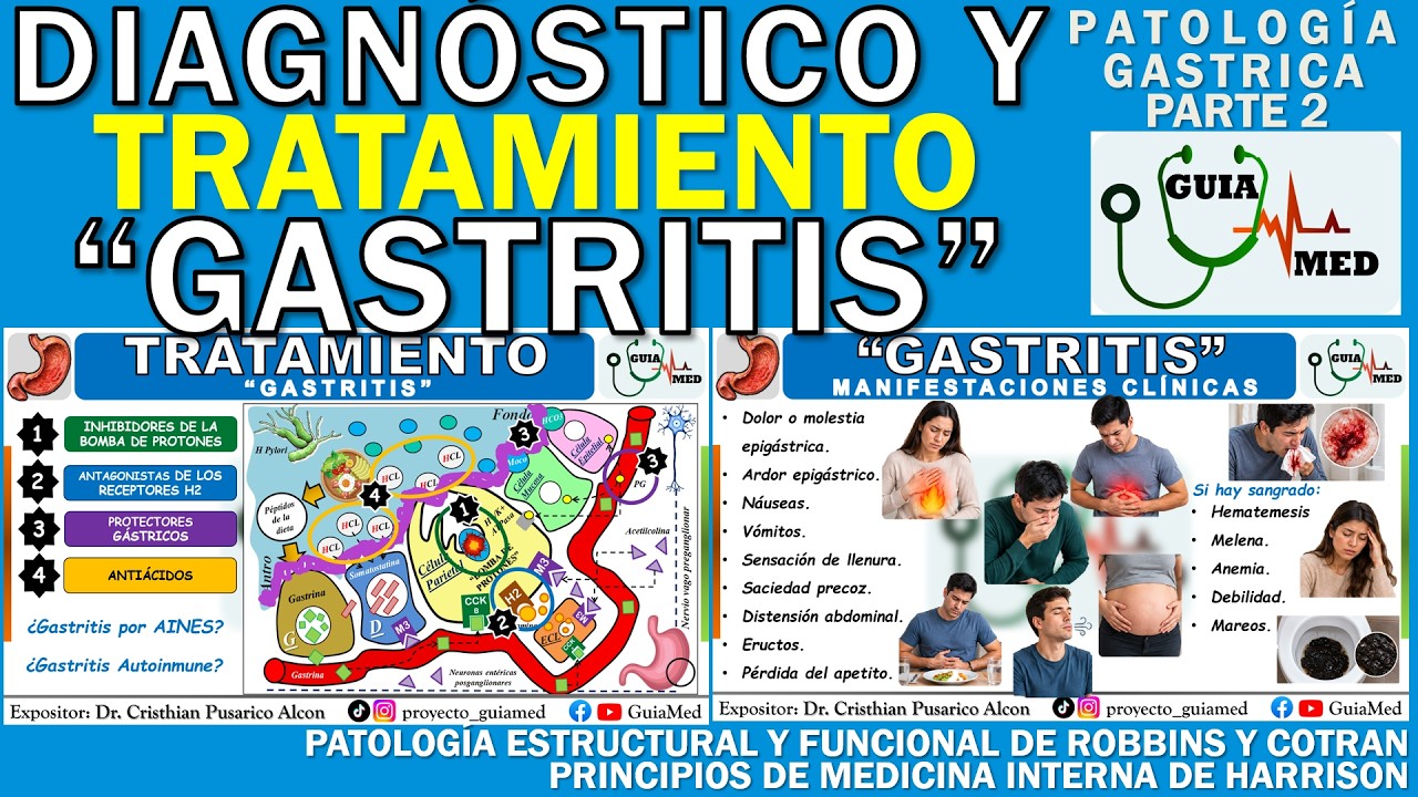 GASTRITIS DIAGNÓSTICO Y TRATAMIENTO | GuiaMed