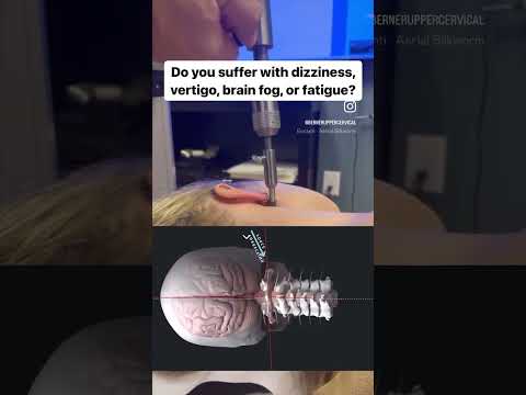 Do you suffer with dizziness, brain fog, vertigo, or fatigue?#orthospinologyl#chiropractor