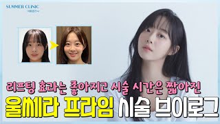 리프팅 효과는 좋아지고 시술시간은  짧아진 울쎄라 프라임 브이로그