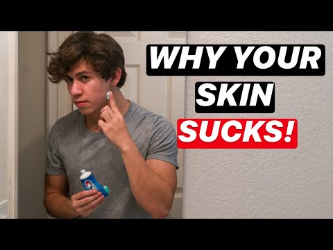 10 Reasons Why Your Skin SUCKS! | Men's Skin Care