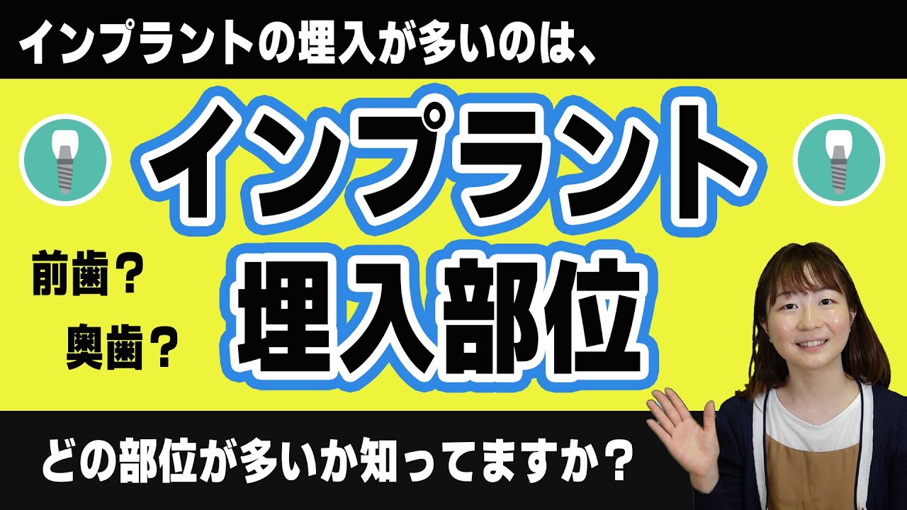インプラント治療を受けた部位として多いのは前歯?奥歯?
