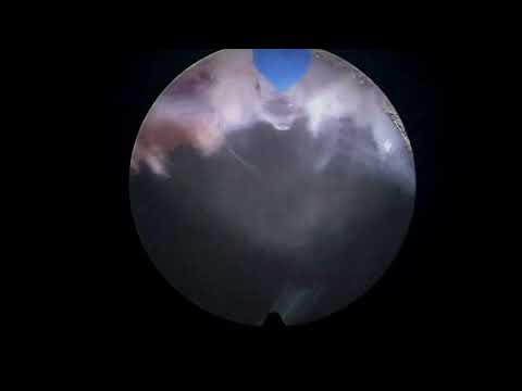 Felipe Amoedo Luedy-19
