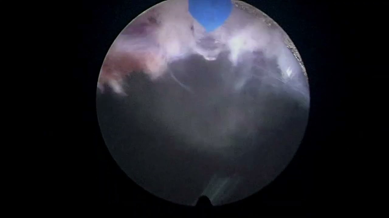 Felipe Amoedo Luedy-19