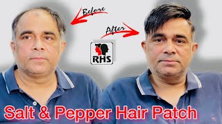 Salt and Pepper Hair Patch | Hair Transformation | Hair Patches For Men | Black & White Hair Patch.