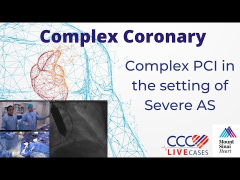 Complex PCI in the setting of Severe AS - April 17, 2018