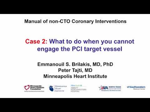 Case 2: PCI Manual - What to do when you cannot engage the PCI target vessel