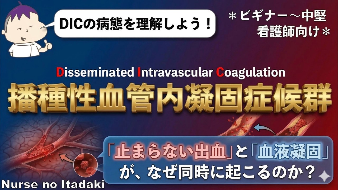 【DICを理解しよう！】なぜ｢止まらない出血｣ と ｢血液凝固｣ という矛盾が起こるのか？