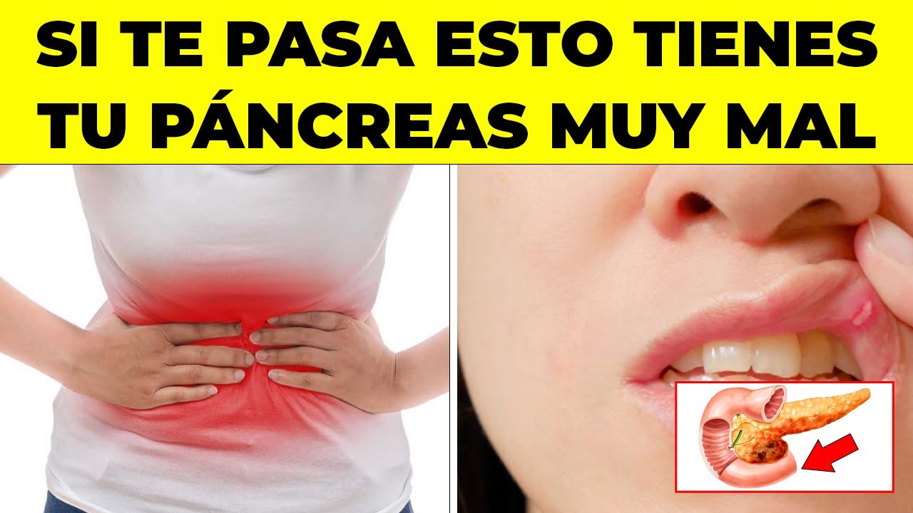 SI Sientes Esto "RARO" TU PÁNCREAS YA NO FUNCIONA