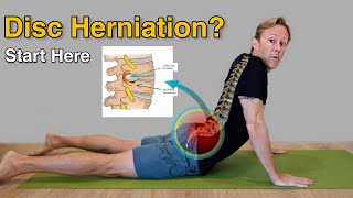 Lumbar Disc Bulge & Herniation Exercises | Rehab That Actually Reduces Back and Leg Pain