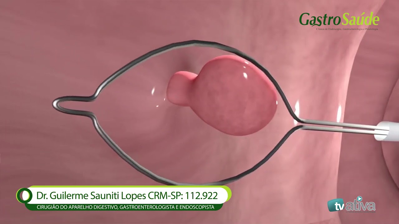 Guilherme Sauniti Lopes-6