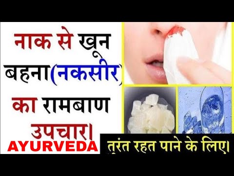 नकसीर का उपचार/nose bleeding ayurvedic treatment/नकसीर का घरेलू उपचार Video
