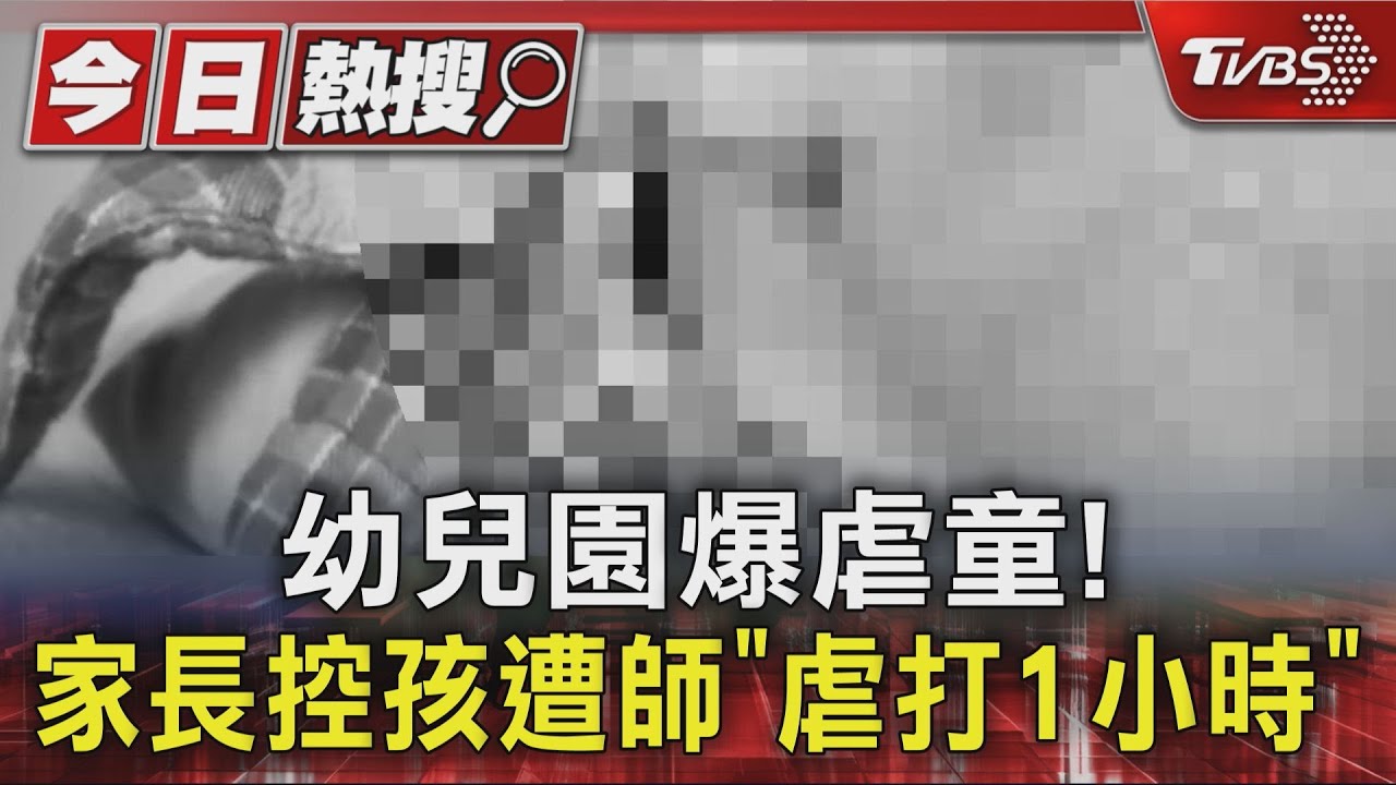 控幼兒園師施暴1小時!童臉腫耳傷 家長調監視器怒了