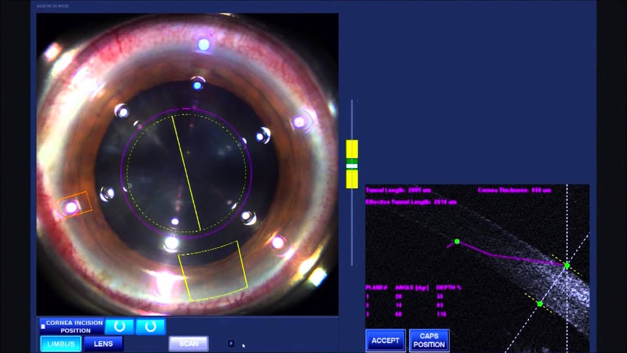 Jorge Luis Domene Hinojosa-12
