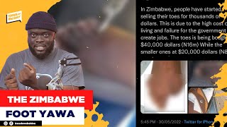 Reactions As People Are Selling Their Toes For Thousands Of Dollars In Zimbabwe