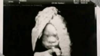 Cassper nyovest ( loco audio song)