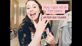 How to Get Rid of Flat Warts! | How I FINALLY got rid of warts after SIX YEARS! | Natural Remedies!