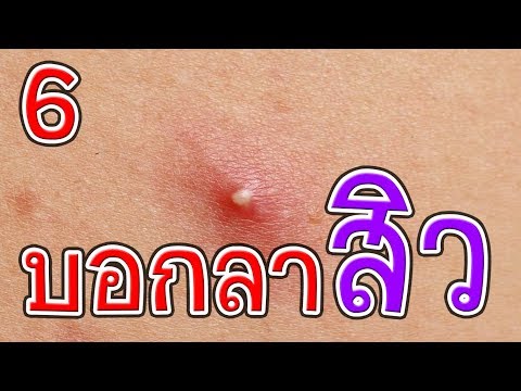 ก้อนเล็ก ๆ ใต้ผิวหนังบนหน้าอก ครีมสำหรับเต้านมจาก Pynzar Darya