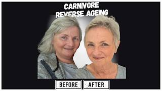 How Carnivore Reversed 35 Pounds and Chronic Pain