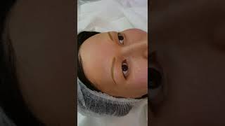 Alopecia Eyebrows Microblading by El Truchan @ Perfect Definition