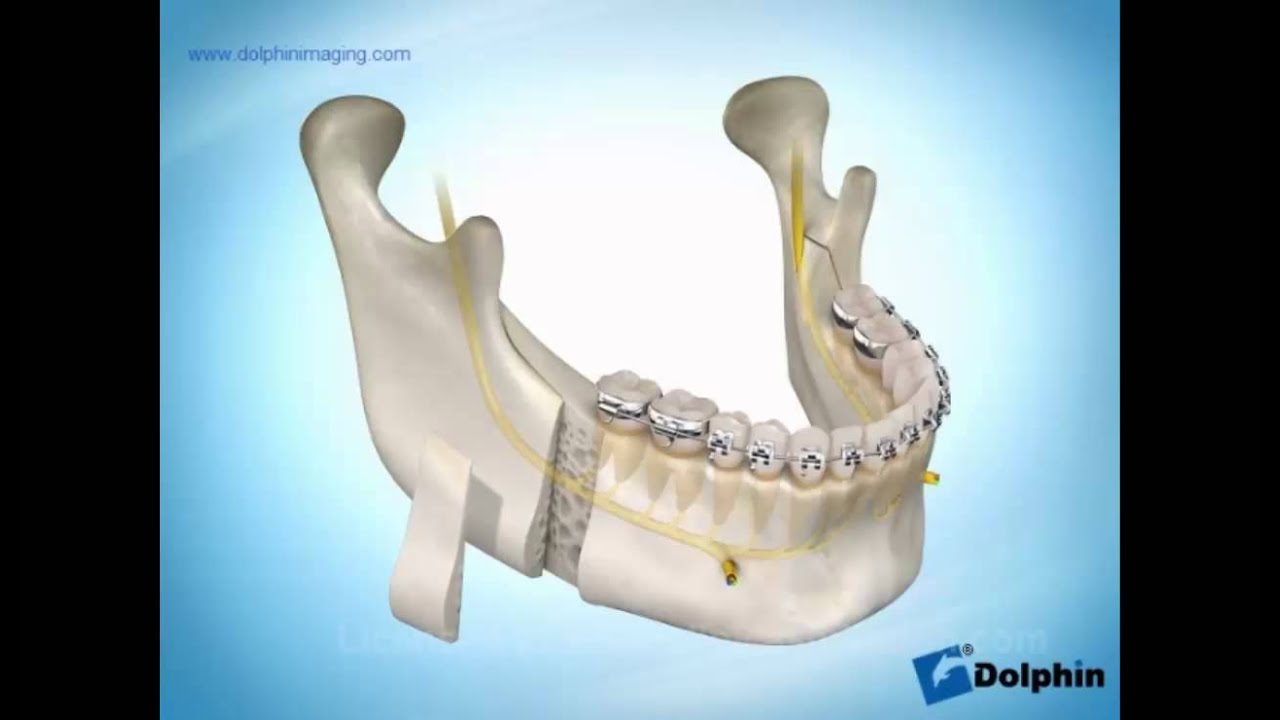 Marcela Lacharme Parada-3