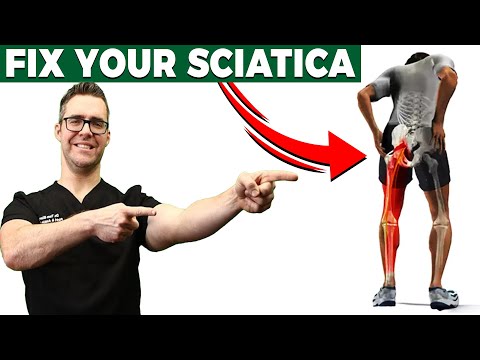 , title : 'How To Cure Sciatica Permanently [Treatment, Stretches, Exercises]'