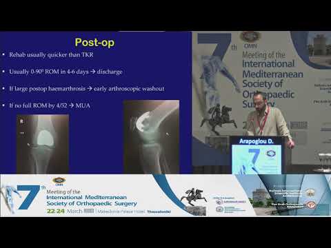 Arapoglou D - Joint Replacement For Patello-Femoral Joint Arthritis (PFJA)