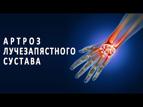 Osteocondrosi lombare Codice CIM 10 in ICD 10 Il riscaldamento balsamo per le articolazioni