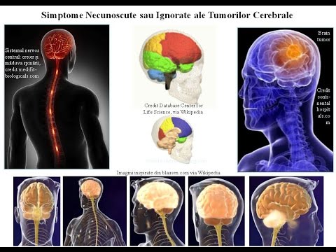 Inflamația tendonului simptomelor articulației cotului