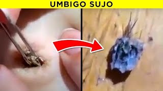 Pessoas Que Não Tomam Banho Há Anos