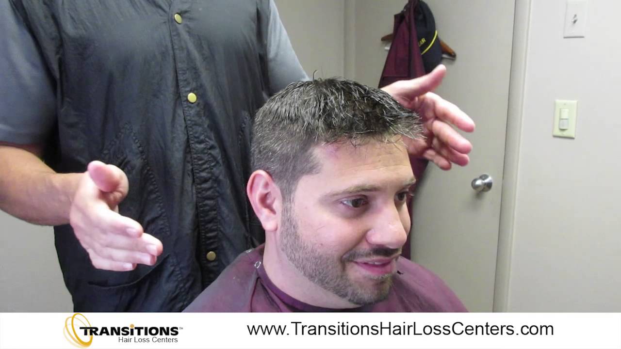 Taking The Fear Out of Hair Loss Solutions For Men
