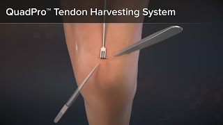 QuadPro™ Tendon Harvester