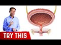 The Best Bladder Remedy I Know