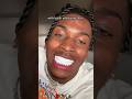How To Get The Whitest Teeth In The World! 😬🦷