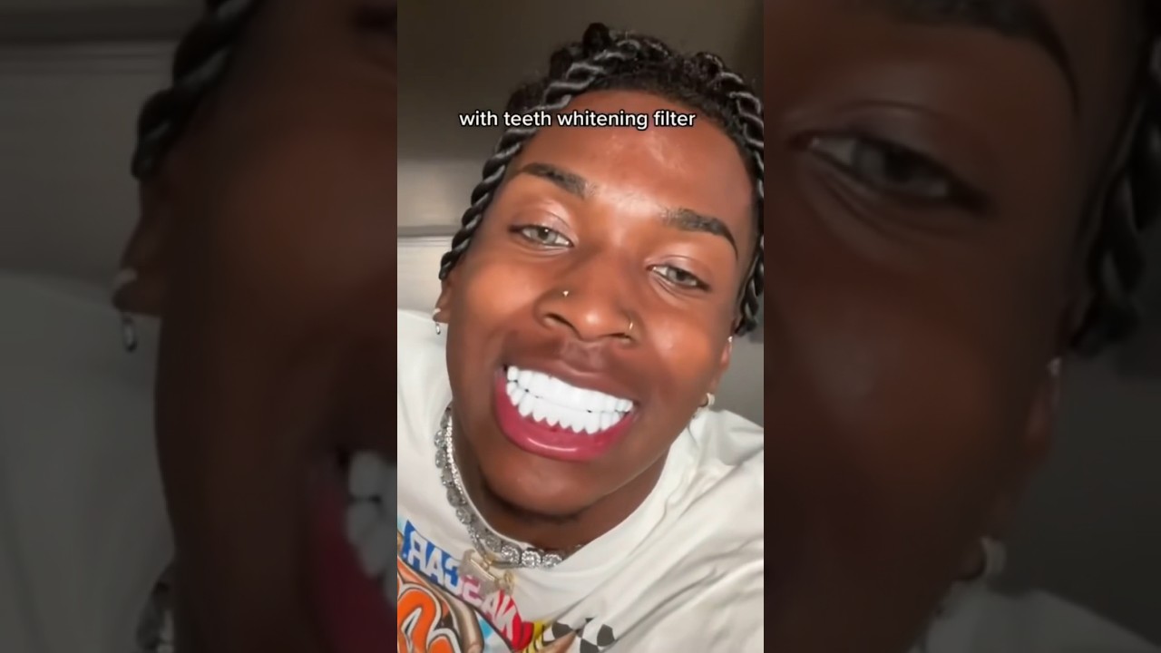 How To Get The Whitest Teeth In The World! 😬🦷