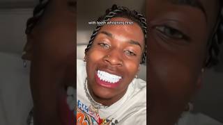 How To Get The Whitest Teeth In The World! 😬🦷