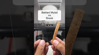 Download lagu Begini jadinya jika bakteri mulut diberi siwak #mikroskop #siwak #mikrobiologi #kuman #zoom mp3 Download lagu Begini jadinya jika bakteri mulut diberi siwak #mikroskop #siwak #mikrobiologi #kuman #zoom mp3