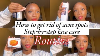 How to get rid of dark acne spots | face care step by step routine |#affordable  #theordinary