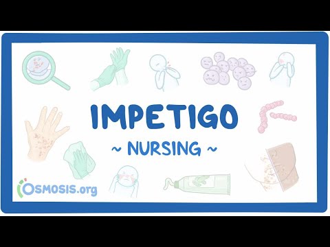 Influenza Clinical Nursing Care