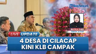 4 Desa di Cilacap Masuk Kategori KLB Campak, Dinas Kesehatan Galakkan Vaksinasi