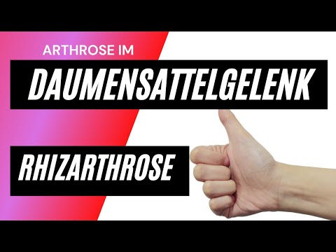 Arthrose im Daumensattelgelenk - Rhizarthrose